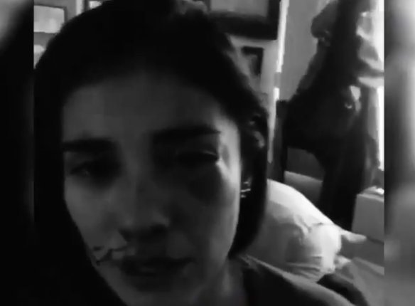 golpiza a actriz colombiana & Fuente> Instagram @despiertaamerica