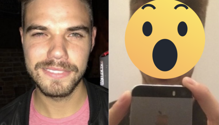 joven se tiñe el pelo y se deforma el craneo