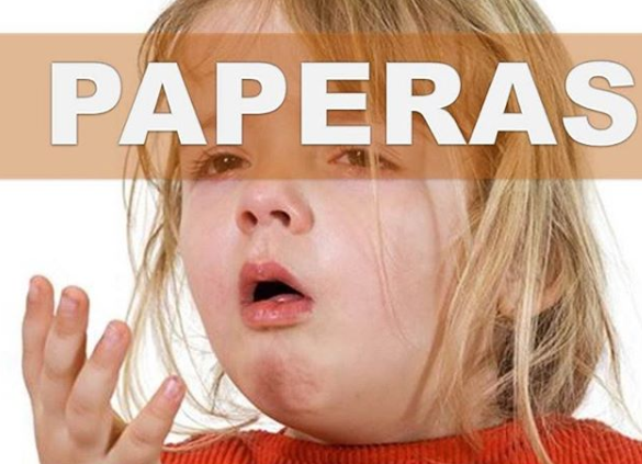 paperas/ Fuente: Instagram @vacusalud_ca