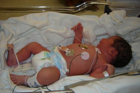 Confirman brote de bacteria infecciosa en 7 bebés en IMSS del Edomex