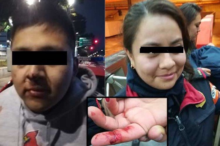 !Caníbal! Sujeto arranca un pedazo de dedo a mujer policía en el metro. Noticias en tiempo real